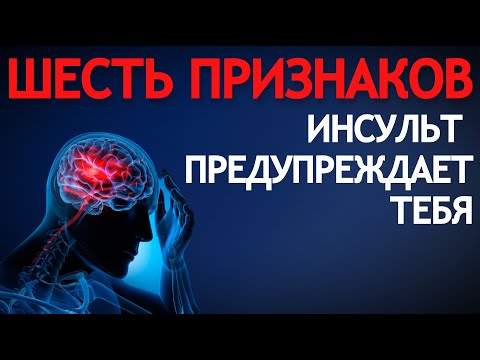 Инсульт ПРЕДУПРЕЖДАЕТ ТЕБЯ. Шесть признаков.