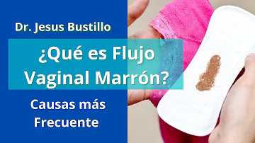 ¿Cómo se llama el flujo marrón después de la regla?