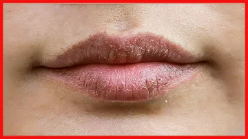 ¿Se resecan los labios después de besar?