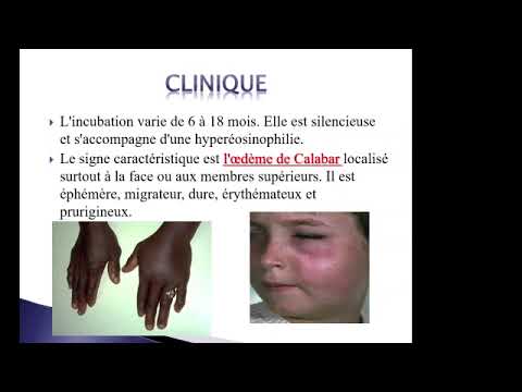 FILAIRES ET FILARIOSES