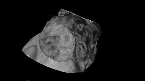 MicroCT videos of rat heart and porcine skin injection