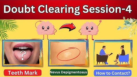 Doubt Clearing Session-4