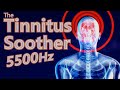 Tinnitus Soother is Mid-Range Focused 5500Hz Noise