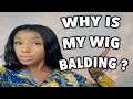 How To Avoid Wig Shedding/ Baldind Lace | Everything You need To Know