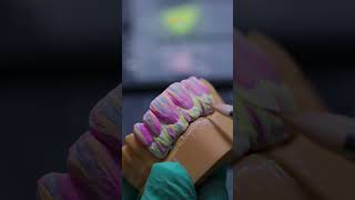 Precision Down To The Micron