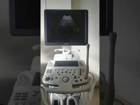 Medison Sonoace X8 Manual Meat Medison Sonoace X8 Manual Meat