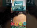 الشبكيه وداعا للصلع Elbatal Group تركيب شعر للرجال الشبكيه الفرنسيه تيجه Wigs مصر Hair 