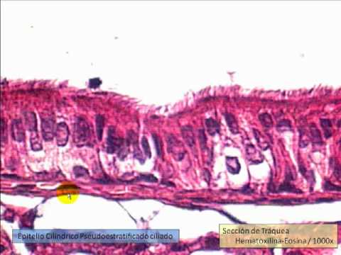 Vídeo: Diferencia Entre Histopatología Y Citología