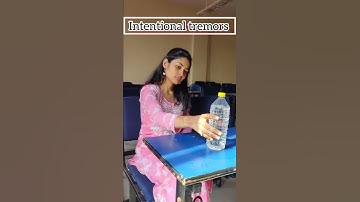 Signs of CEREBELLAR DAMAGE || Neurology #shorts #neurology