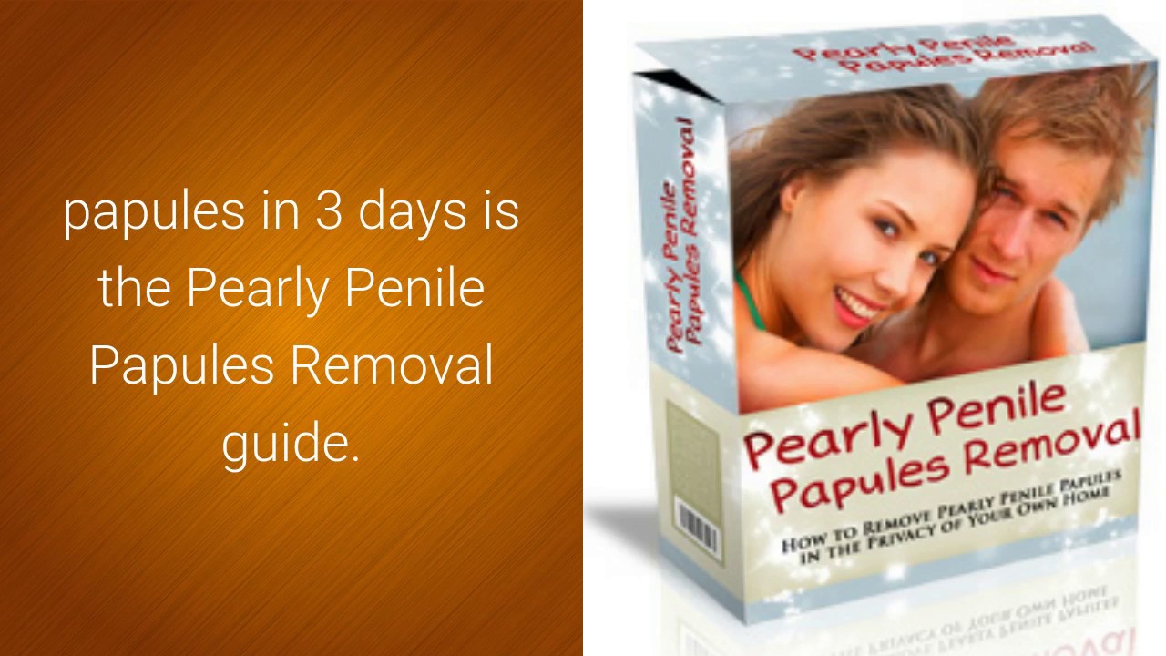Pearly penile away go will papules How to