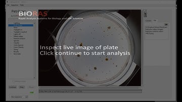 Petrilyzer automatic colony counter