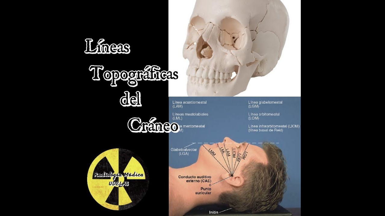 LÍNEAS TOPOGRÁFICAS DEL CRÁNEO