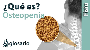 ¿Qué desencadena la osteopenia?
