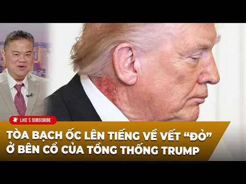 Cà Phê Sáng P5 (03-03-2026) Tòa Bạch Ốc lên tiếng về vết “đỏ” ở bên cổ của Tổng thống Trump