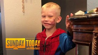 Boy, 6, Saves Younger Sister From Dog Attack – And Gets Noticed By Captain America | Sunday TODAY