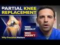 Partial Knee Replacement Explained: Who Needs It &amp; Why Precision Matters