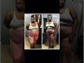 #beforeandafter #weightloss #weightlossjourney #weightlosstransformation #shortsvideo