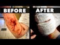 24 HOURS AFTER HER BRUTAL DOG ATTACK... | Dr. Paul