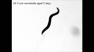 A conserved KLF-autophagy pathway modulates nematode lifespan and mammalian age-associated vascular