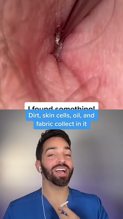 Find you someone that cleans your belly button @SatisfyingExtraditions #dermdoctor #bellybutton #de