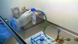 10 Demonstration of processing of sputum specimen for culture for diagnosis of tuberculosis