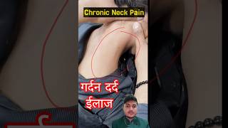 Dry needling #neckpain #dryneedlingtherapy #dryneedlingtherapy #painrelief