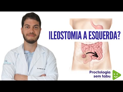 Existe ileostomia do lado esquerdo da barriga?