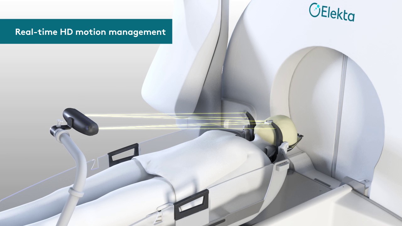 El hospital Ruber Internacional estrena en España la tecnología más avanzada de radioterapia