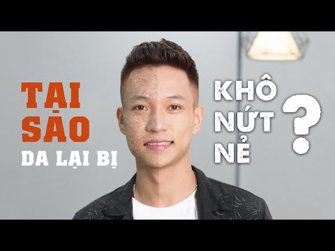 Tại Sao Da Lại Bị Khô Nẻ | Bí Quyết Làn Da Không Khô Nẻ