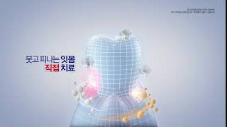 [2017 잇치 직접 치료 여자]편 TV-CF 5초