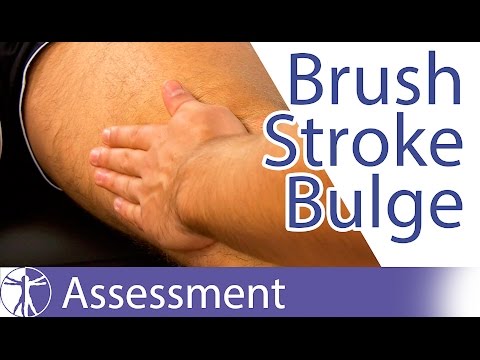 Brush, Stroke, Bulge,Swipe Testi / Diz Efüzyonu