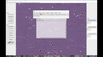 Fiji - Neutrophil Count and Tracking plugin - Demonstration