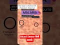 ब्लड smear कैसे बनता हैं देखो