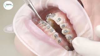 عيادة اسنان , 65859285 عيادات  تقويم الاسنان و تنظيف وزراعة , عيادة دكتور تقويم اسنان عيادة للاطفال