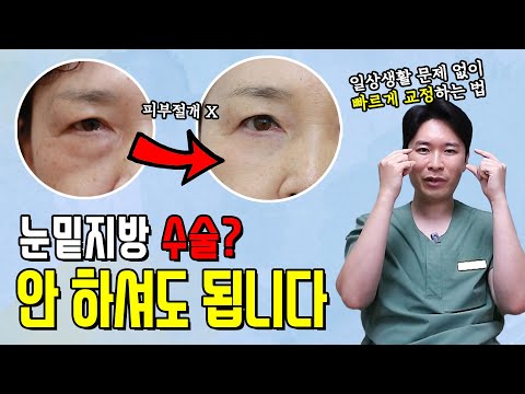   눈밑지방없애는법 피부 절개 수술 없이 일상생활로 빠르게 복귀하는 방법