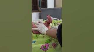 Cara Memandikan bayi baru lahir yang belum puput