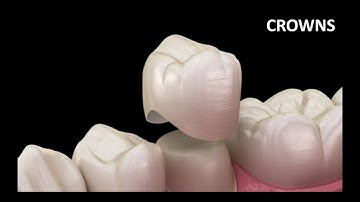 Clara Moukarzel Biomaterials Presentation