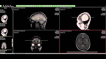 MedPac Systems Web Based PACS Dicom Viewer MRI Scout/Localizer/Reference Lines