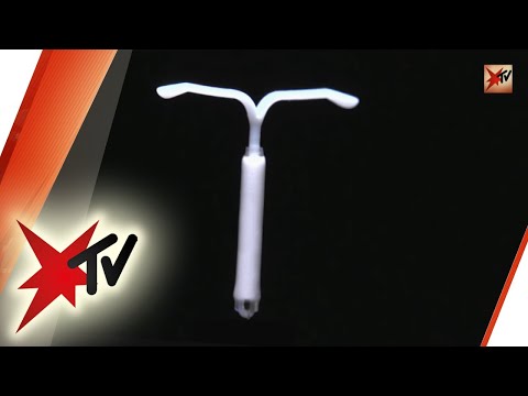 Video: Könnte iud eine Pilzinfektion verursachen?