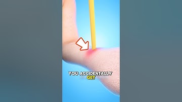 What to Do If a Pencil Stabs Your Hand