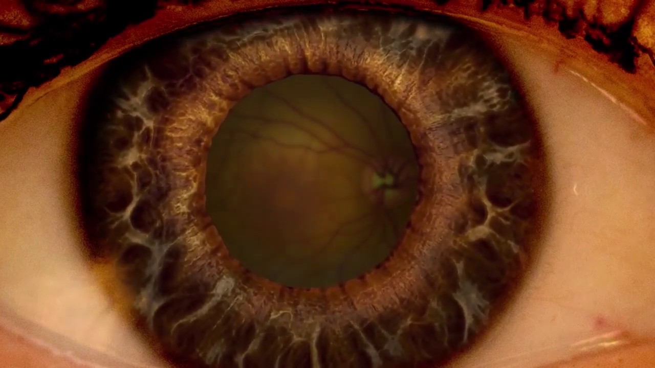 HindSight Eyecare Dilated Eye Exam, The Villages FL YouTube