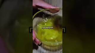 Варикоз — ВСË. Доктор Мясников про НОВЫЙ Способ ЛЕЧЕНИЯ Варикоза!