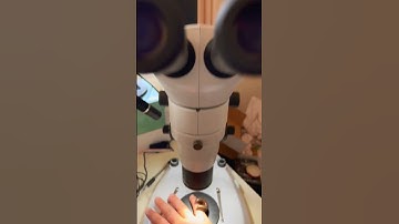 One of the worlds strangest blood-sucking pets...