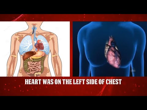 Heart Was On The Left Side Of Chest - YouTube