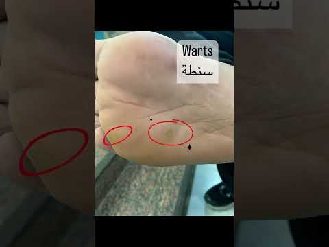    تعالوا معايا عيادة الجلدية