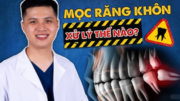 MỌC RĂNG KHÔN ĐAU LÂU KHÔNG ? XỬ LÍ NHƯ THẾ NÀO | NHA KHOA LẠC VIỆT INTECH