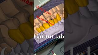 Multi layer диоксид циркония #smiledesigndental #dentist #dentalcrowns #stomatology #dentalcaddesign