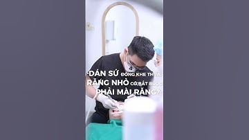 Dán sứ Veneer đóng khe thưa cực đỉnh  #nhakhoasunrise #dansuveneer #beauty #matdansu