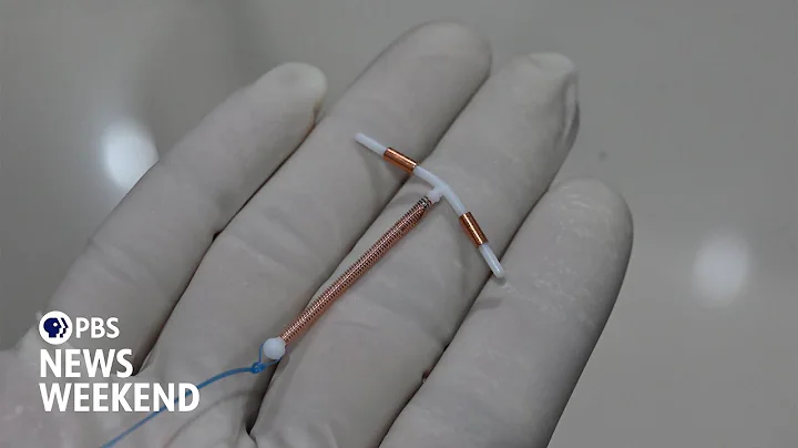 Why IUD insertions are painful for many patients and what can be done better