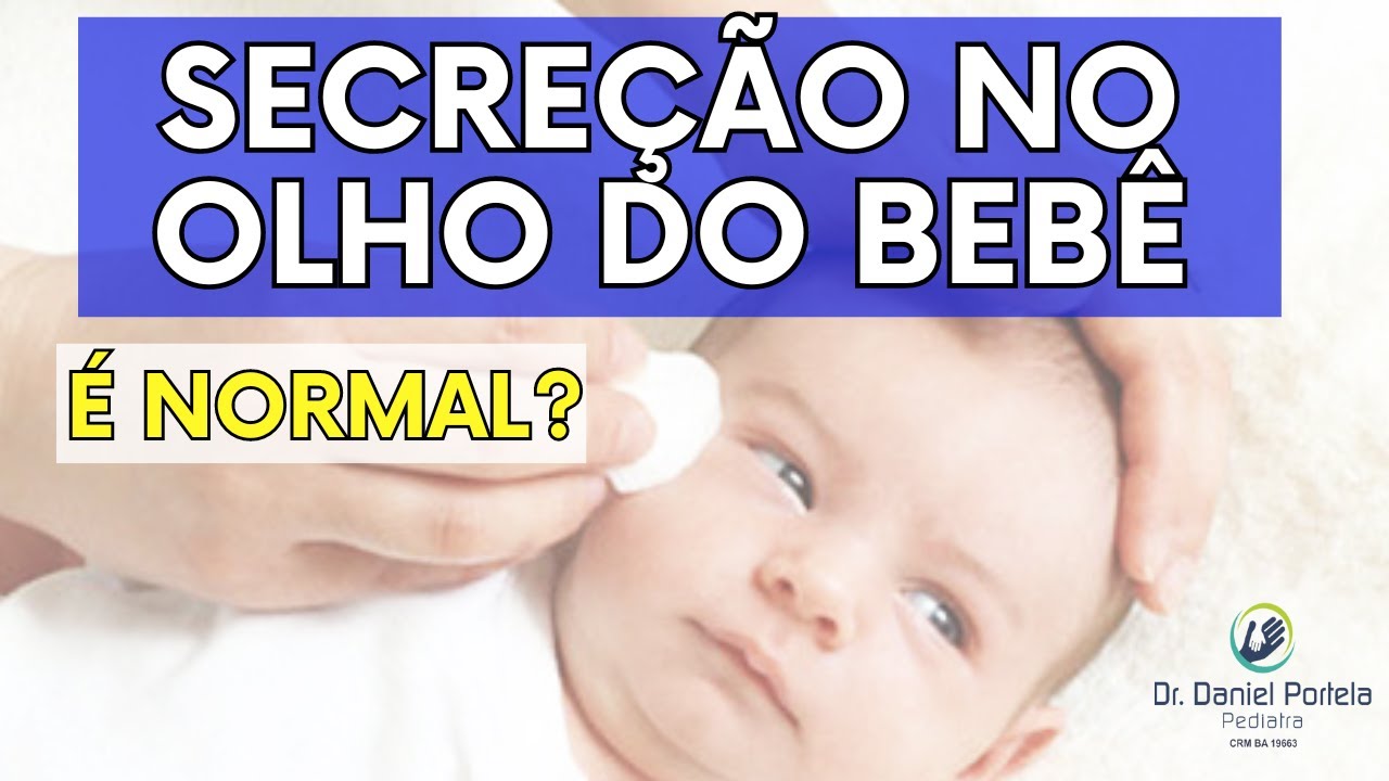 Bebê lacrimejando com remela nos olhos desde que nasceu - YouTube